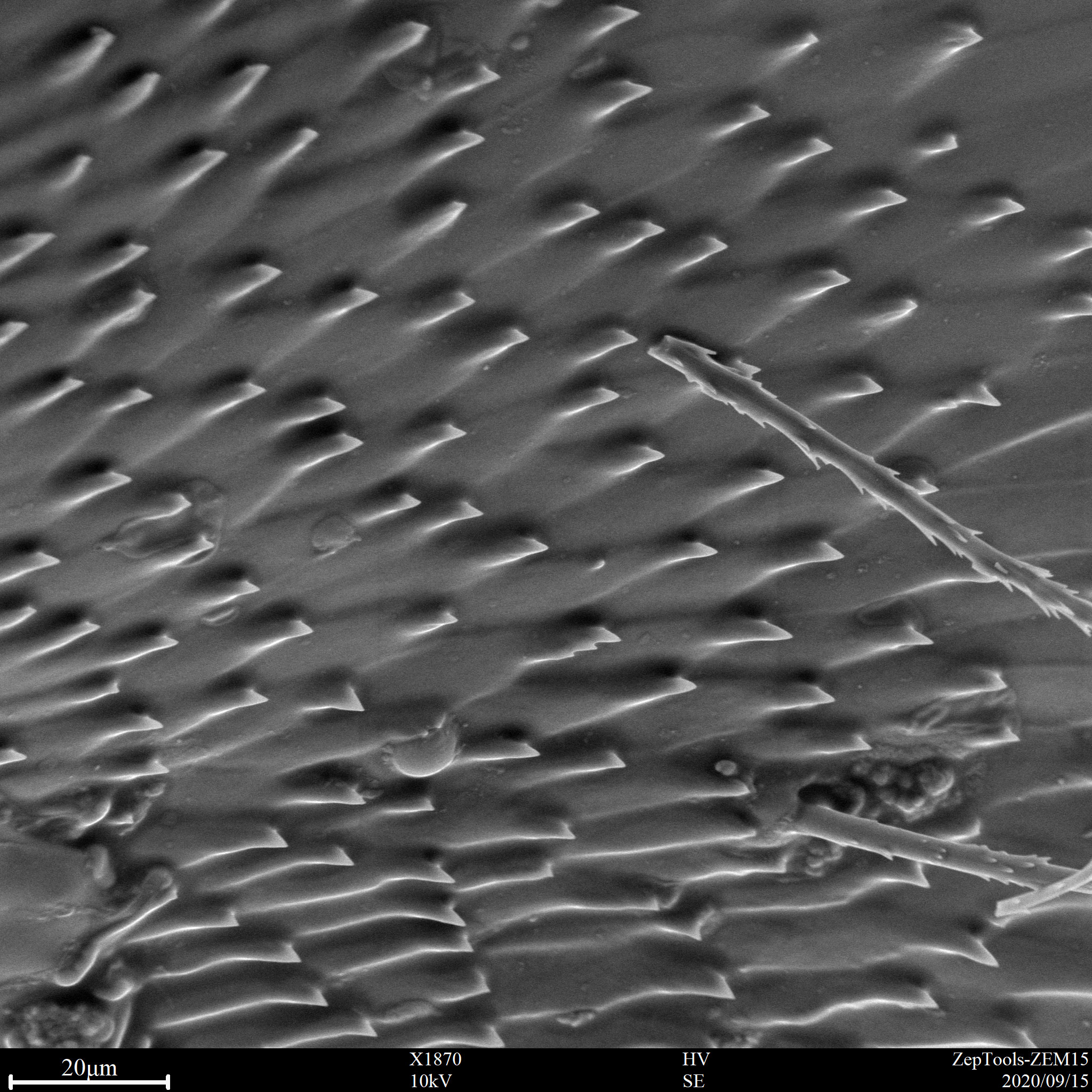 臺(tái)式掃描電鏡下生物樣品(會(huì)議現(xiàn)場(chǎng)拍攝) 臺(tái)式掃描電鏡下生物樣品(會(huì)議現(xiàn)場(chǎng)拍攝)